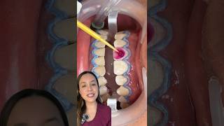 Conoce el paso a paso del blanqueamiento dental 🦷 [upl. by Nahgeam400]