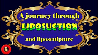 A journey through liposuction and liposculpture Part 610 [upl. by Shivers]