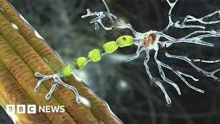 Truly remarkable drug can reverse decline caused by motor neurone disease  BBC News [upl. by Brice]