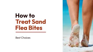 How to Treat Sand Flea Bites  Soothe Itchy Irritated Skin Fast  Best choices [upl. by Immac]