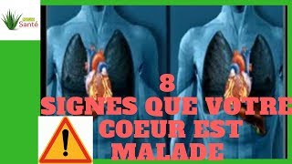 Comment Savoir Si Votre Coeur Fonctionne Mal  8 Signes Indicateurs  Nature Sante [upl. by Truda]