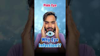 Eye Infection Conjunctivitis Pink Eye  Why is eye Infection Spreading in India fact short [upl. by Nodnnarb643]