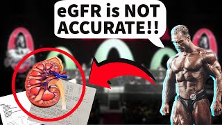 Is eGFR Accurate  Improve Kidney Function In Seconds  Doctors Analysis [upl. by Gore]