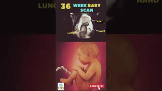 36 week Baby Scan health pregnancy baby zoayahealthcare [upl. by Levitus]