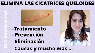 CICATRICES QUELOIDES ▶ Causas prevención y tratamientos ✅ [upl. by Subir]