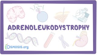 Adrenoleukodystrophy  causes symptoms diagnosis treatment pathology [upl. by Bettine898]