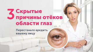 ОТЁКИ И МЕШКИ под глазами НЕОЖИДАННЫЕ причины и одно полезное упражнение [upl. by Rozek404]