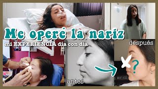 ME OPERÉ LA NARIZ  mi RINOPLASTIA día con día [upl. by Eyde975]