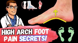 FIX High Arches amp High Arch Feet Supination amp Pes Cavus Foot Type [upl. by Won120]