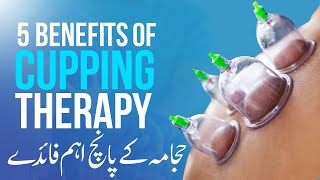 Hijama Kya Hai  Benefits of Cupping Therapy  Hijama K Fawaid  Hijama Therapy Kyun Karwana Chahie [upl. by Karyl]