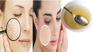 How to Get Rid of Dry Skin in Winters । Dry Skin Care Tips Cracked Skin Home Remedies [upl. by Gehlbach280]