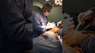 laparotomy surgery  laparotomy procedure step by step  shorts  trending  nursing  doctor [upl. by Rena]