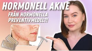 Varför du har Hormonell Akne  Har hormonella preventivmedel någon inverkan [upl. by Naor129]