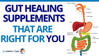 GutHealing Supplements That Are Right For You [upl. by Melodee875]