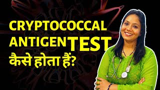 Cryptococcal Antigen Test Procedure in Hindi  Cryptococcal Infection Test [upl. by Saibot]