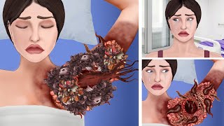 ASMR Remove leeches amp Ticks from infected girl armpit  ASMR Animation Treatment restasmr1 [upl. by Rocca]