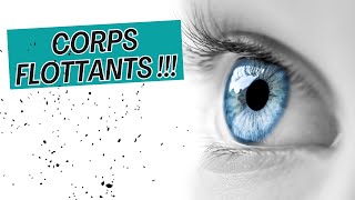 Adieu Corps Flottants Mouches Volantes Points Noirs  4 étapes pour les éliminer  👋👁️ [upl. by Luiza]