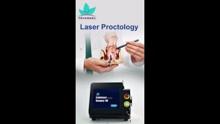 New hemorrhoids diode laser 1470nm 980nm treatment surgery hemorrhoidectomy deviceTriangel V6 [upl. by Anigar]