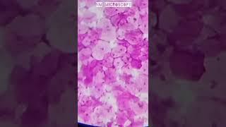 Squamous epithelial cells microscope slide🔬shortvideo youtube [upl. by Wehtta418]