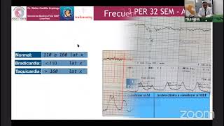 Cardiotocografía Monitoreo Electrónico Fetal Consideraciones Para la Interpretación y el Manejo 2705 [upl. by Essirahc]