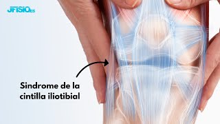 Síndrome de la CINTILLA ILIOTIBIAL  Ejercicios y Tratamiento [upl. by Eineg]