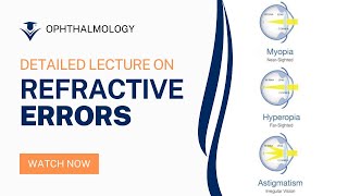 Understanding Refractive Errors in Ophthalmology A Comprehensive Lecture [upl. by Spurgeon]