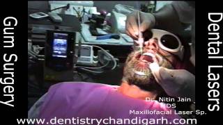 Dental Laser a guide for the patient [upl. by Ahsienyt]