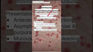 Immune thrombocytopenia [upl. by Ovid726]