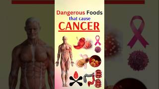 Cancer Causing Foods You Eat EVERY DAY [upl. by Ehrenberg]