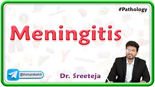 4 Meningitis  USMLE Step 1 Pathology [upl. by Lehrer739]