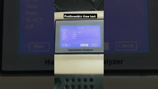 Prothrombin time test  Coagulation test  PT test  INR test  APTT test labtechnician dmlt [upl. by Shaylah431]