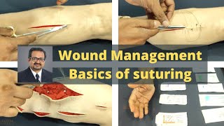 Wound Management  Basics of suturing  How to hold surgical instruments [upl. by Enimisaj]