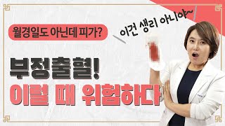 부정 출혈 이렇게 구분해 보세요 부정 출혈 신호등 [upl. by Soo]