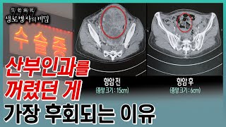 난소암 첫수술이 생존율을 결정한다는데수술과 함께 진단 치료법이 결정되는 난소암과의 사투 KBS 20230802 방송 [upl. by Ardnoyek]