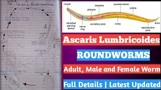 ascaris Lumbricoides  life cycle of ascaris Lumbricoides  एस्केरिस लुम्ब्रिकोइड्स क्या है [upl. by Ecinaej]