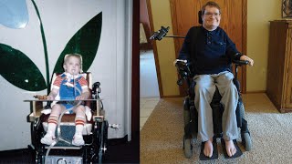 Starting 39th Year of Quadriplegia [upl. by Nerreg664]