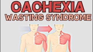 Cachexia  Wasting Syndrome  Explained [upl. by Eidnarb]