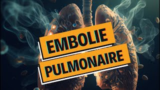 EMBOLIE PULMONAIRE et PHLEBITE  tout comprendre  WhyDoc 1 [upl. by Lisle]