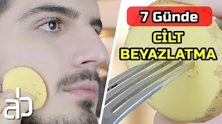 1 PATATES İle 7 Günde Cilt Beyazlatma  \u00100 İşe Yarıyor   │ Cilt Bakımı [upl. by Robenia306]