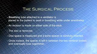 Anterior Cervical Discectomy and Fusion ACDF [upl. by Suivart872]