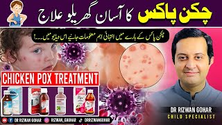 Effective chicken pox treatment🦠🤒 What you need to know chickenpox treatment [upl. by Netsua]