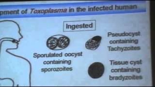 DrAzaa 10  Toxoplasmosis [upl. by Nayr]