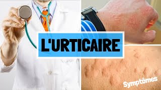 URITCAIRE  CAUSES  SYMPTOMES  COMPLICATIONS  TRAITEMENT [upl. by Veta]