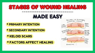 Wound Healing Pathology  Wounds Healing Process of Skin Regeneration and Repair Stages [upl. by Atonsah]