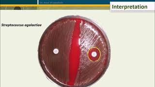 Bacitracin test for Streptococcus pyogenes [upl. by Sacci]