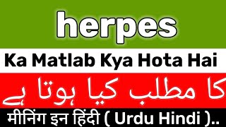 Herpes Meaning  Herpes Meaning In Urdu  Herpes Ka Matlab Kya Hota Hai  Herpes Ka Meaning Kya Hai [upl. by Tnarg]