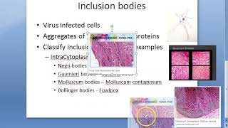 Microbiology 447 a Inclusion Bodies Virus negri bodies classify guarnieri vaccinia molluscum [upl. by Ettegdirb]