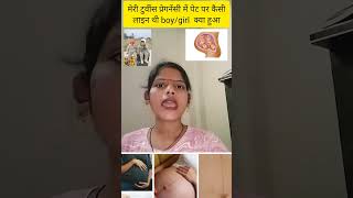 Meri twins pregnancy me pet par kaisi line thi or mujhe girl boy kya huye hai twinpregnancy short [upl. by Claiborne]