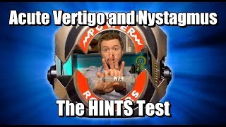 Acute Vertigo and Nystagmus HINTS Test [upl. by Aracot298]