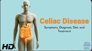 Celiac Disease Explained Symptoms Diagnosis and Treatment [upl. by Ainessej]